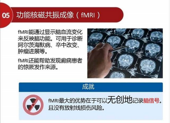 功能核磁共振成像(fMRI)